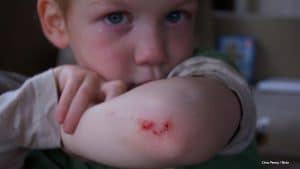 First Aid at Home